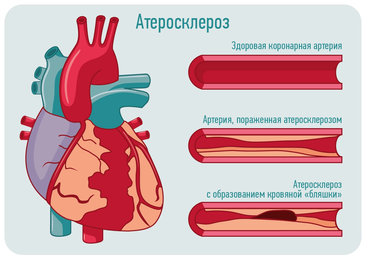 endoscopy3.png