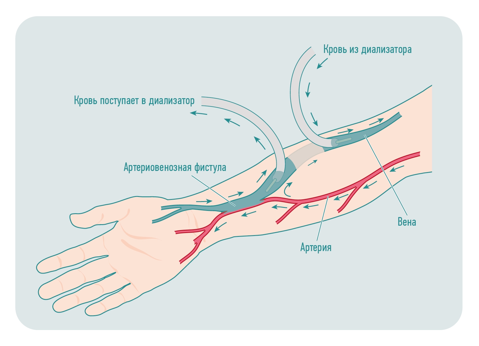 Флебология в Немецкой семейной клинике