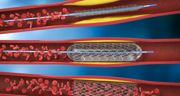 Флебология в Немецкой семейной клинике