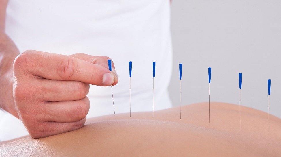 acupuntura-1-3.jpg