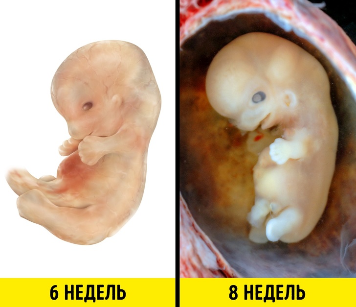 Эмбрион На 3 Неделе Беременности Фото